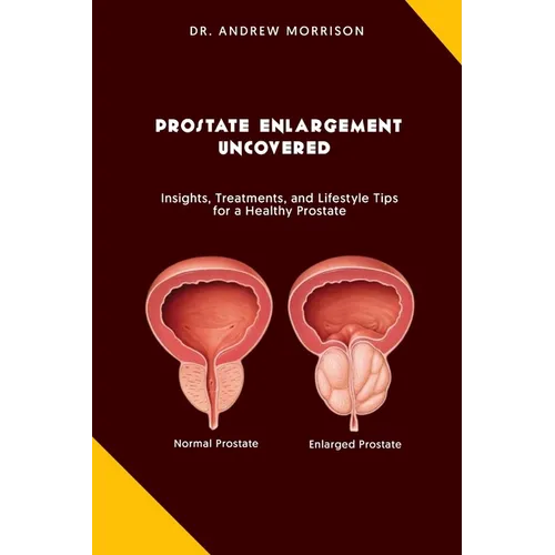 Prostrate Enlargement Uncovered: Insights, Treatments, and Lifestyle Tips for a Healthy Prostate
