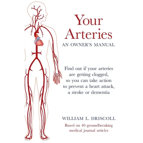 Your Arteries-An Owner's Manual: Find out if your arteries are getting clogged, so you can take action to prevent a heart attack, a stroke or dementia