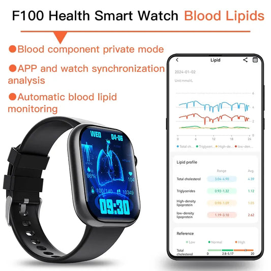 Best ECG Smart Watch of 2024 With Blood Pressure Monitor+Blood Glucose Monitoring - Wautton Outdoor Gear - Little Red General Store