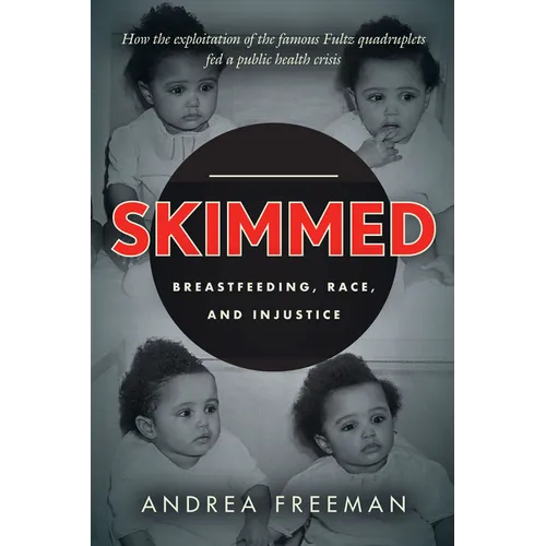 Skimmed: Breastfeeding, Race, and Injustice