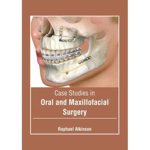 Case Studies in Oral and Maxillofacial Surgery
