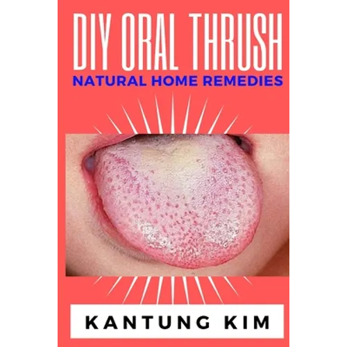 DIY Oral Thrush Natural Home Remedies: The Effective Step By Step Guide To Permanently End Oral Thrush