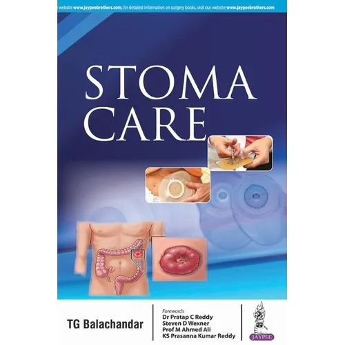 Stoma Care