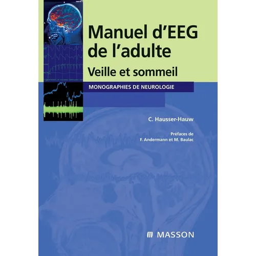 Manuel d'EEG de l'adulte: Veille et sommeil