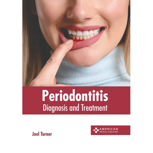 Periodontitis: Diagnosis and Treatment