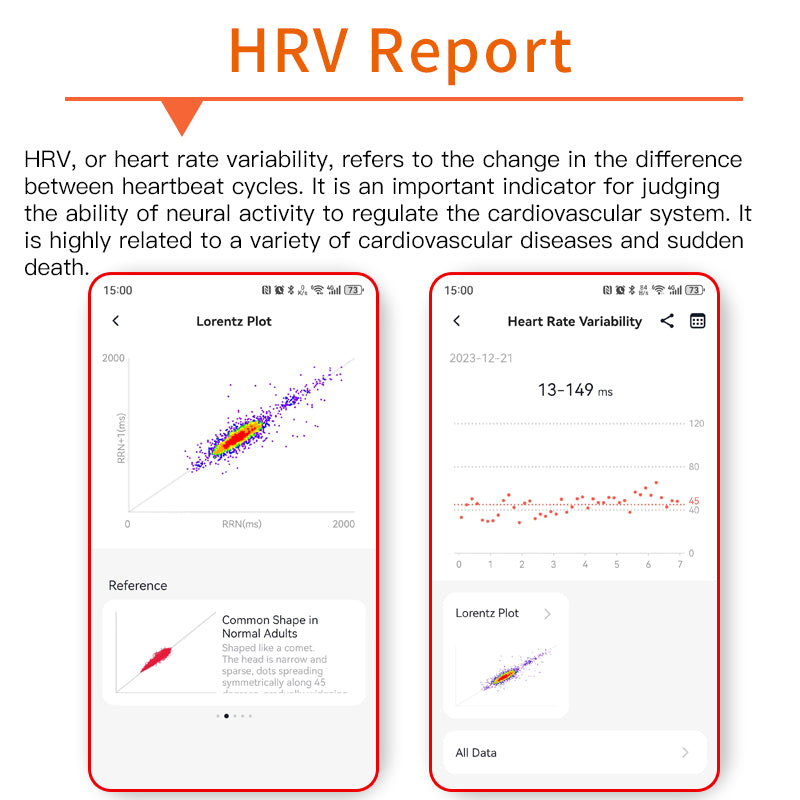 2024 New Accurate Measure ECG+PPG Smart Watch Men Full Touch Screen Sport Fitness Watches Bluetooth For Android ios Smartwatch