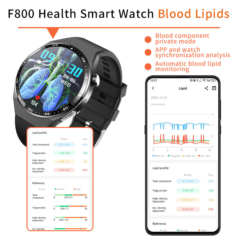 2024 New Accurate Measure ECG+PPG Smart Watch Men Full Touch Screen Sport Fitness Watches Bluetooth For Android ios Smartwatch