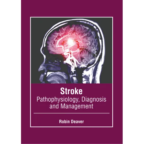 Stroke: Pathophysiology, Diagnosis and Management