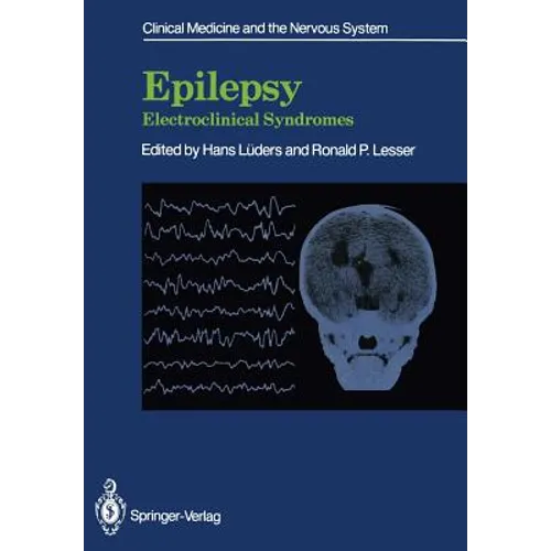 Epilepsy: Electroclinical Syndromes