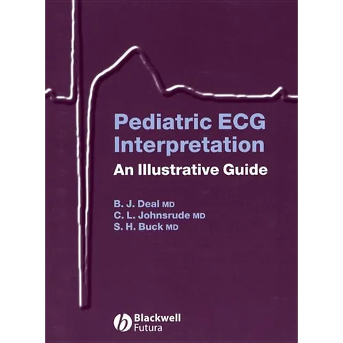 Pediatric ECG Interpretation: An Illustrative Guide [With CD]
