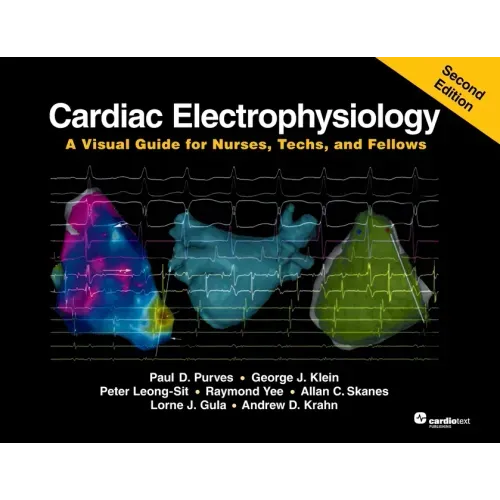 Cardiac Electrophysiology: A Visual Guide for Nurses, Techs, and Fellows, Second Edition