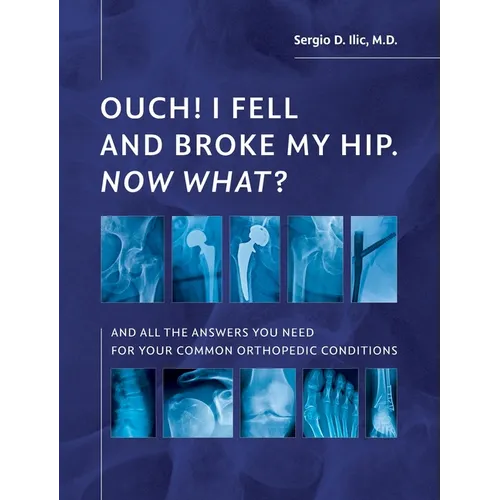 Ouch! I Fell and Broke My Hip. Now What?: And All the Answers You Need for Your Common Orthopedic Conditions