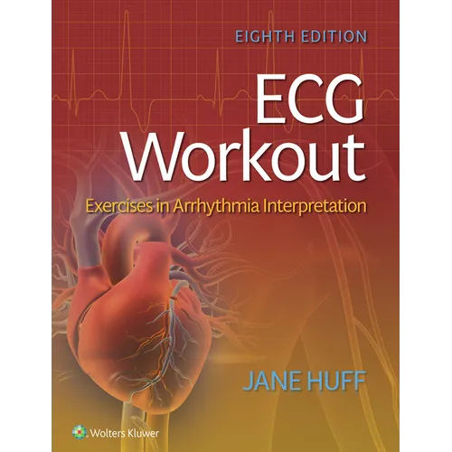ECG Workout: Exercises in Arrhythmia Interpretation