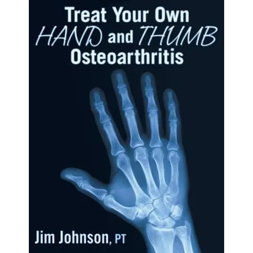 Treat Your Own Hand and Thumb Osteoarthritis