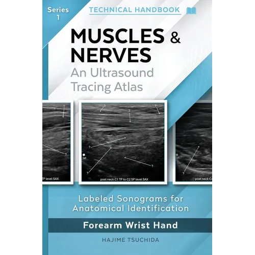 MUSCLES & NERVES - Technical Ultrasound Handbook of the Forearm, Wrist and Hand (Series 1): An Ultrasound Tracing Atlas