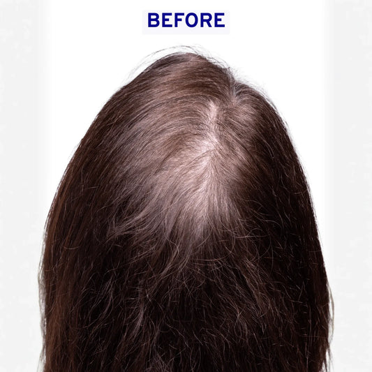 Hair & Scalp Serum | Hydration & Shine
