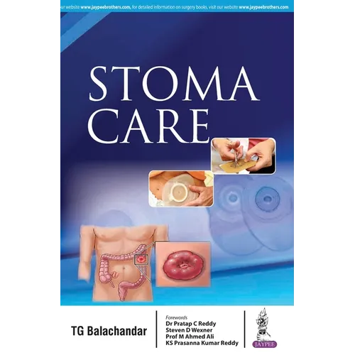Stoma Care