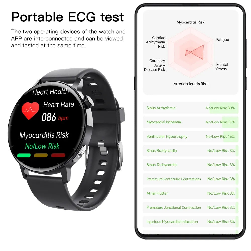 ECG monitor Smart Watch Non Invasive Blood Glucose Smart Watch with Blood Component Analysis - Wautton Outdoor Gear - Little Red General Store