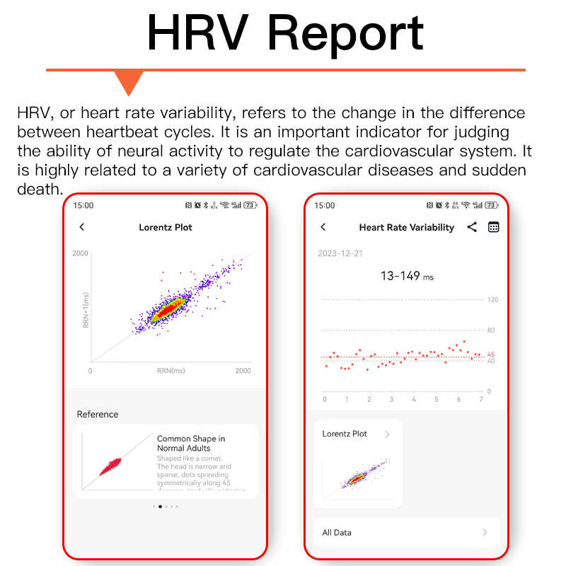 ECG smart watch with blood pressure monitor body temperature blood glucose heart rate blood oxygen - Wautton Outdoor Gear - Little Red General Store