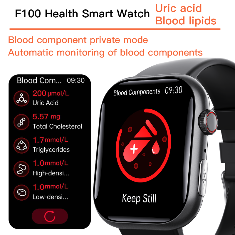 Best ECG Smart Watch of 2024 With Blood Pressure Monitor+Blood Glucose Monitoring - Wautton Outdoor Gear - Little Red General Store