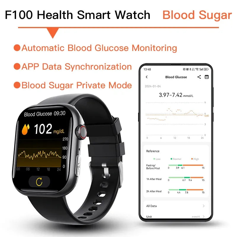 Best ECG Smart Watch of 2024 With Blood Pressure Monitor+Blood Glucose Monitoring - Wautton Outdoor Gear - Little Red General Store