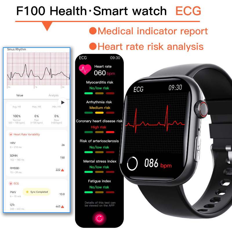 Best ECG Smart Watch of 2024 With Blood Pressure Monitor+Blood Glucose Monitoring - Wautton Outdoor Gear - Little Red General Store
