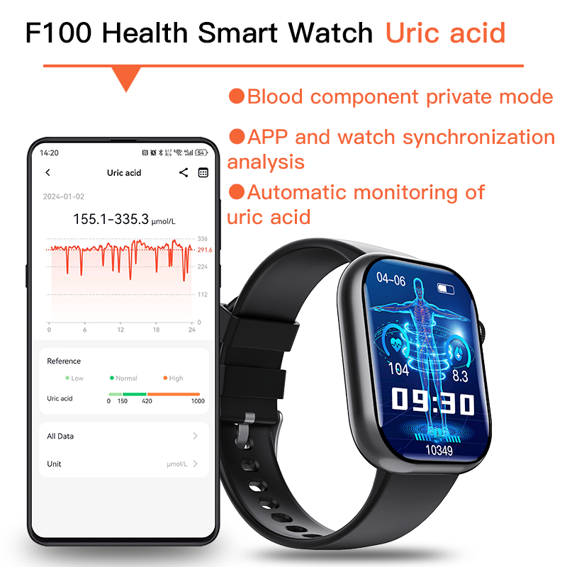 Best ECG Smart Watch of 2024 With Blood Pressure Monitor+Blood Glucose Monitoring - Wautton Outdoor Gear - Little Red General Store