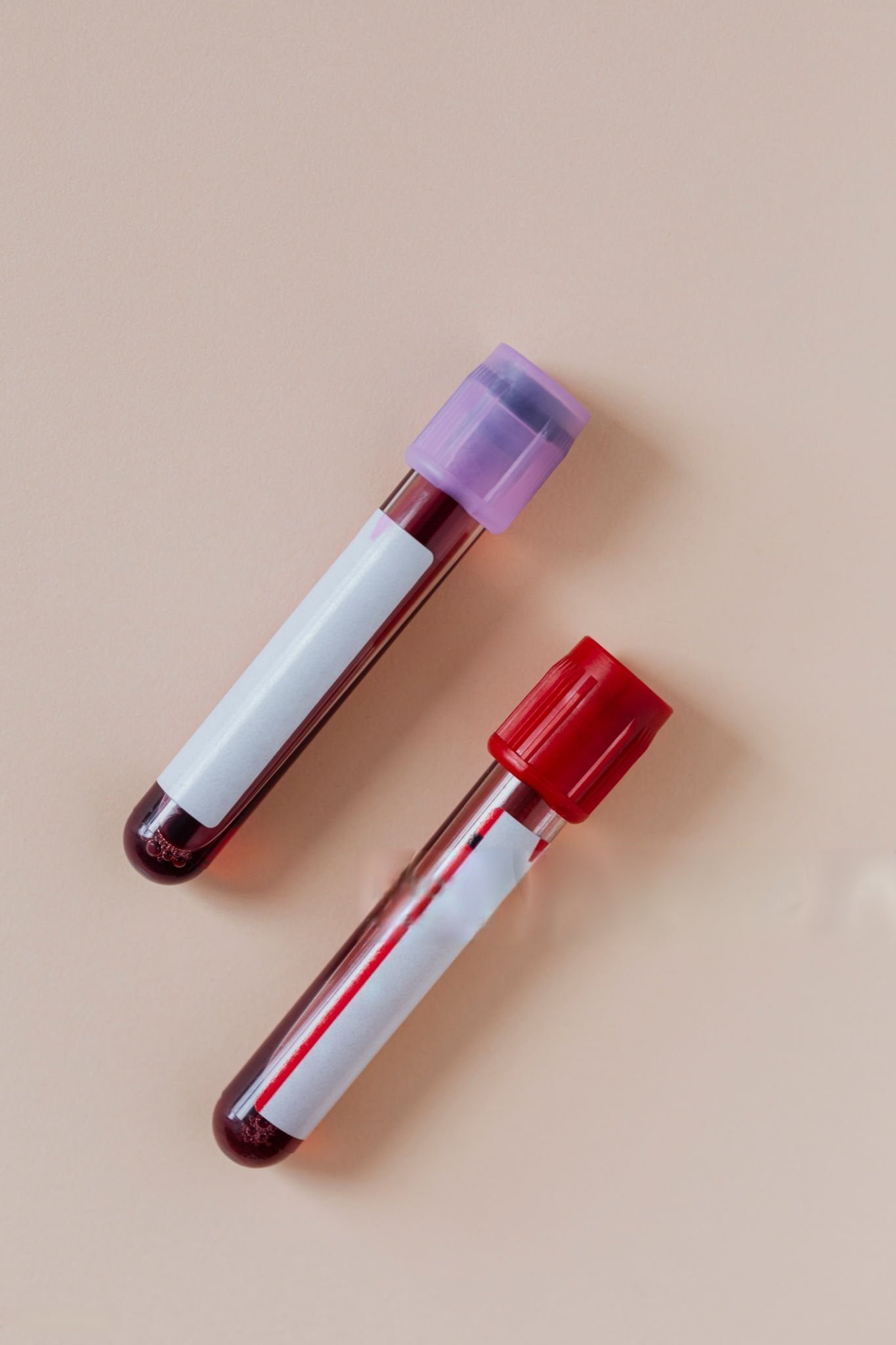 Vitamin D and B12 Panel
