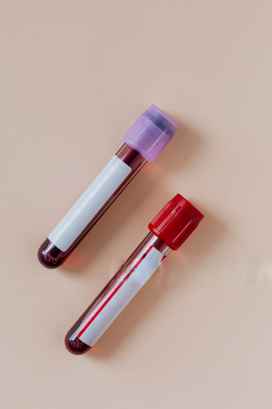 Vitamin D and B12 Panel