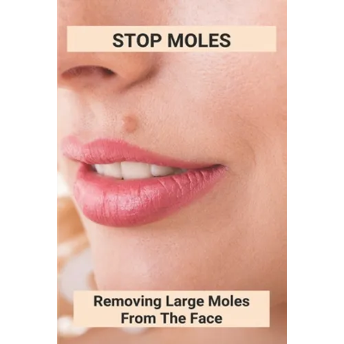 Stop Moles: Removing Large Moles From The Face: Surefire Way To Get Rid Of Moles